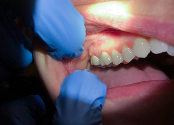 Best Chipped Tooth Repair Near Me  in Tsaile, AZ