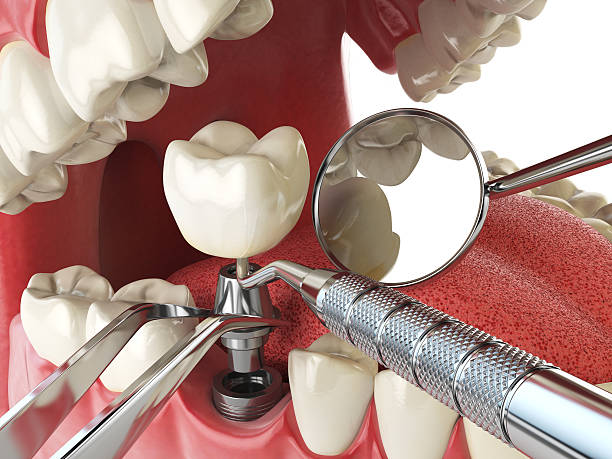 Best Tooth Pain Emergency Relief  in Tsaile, AZ