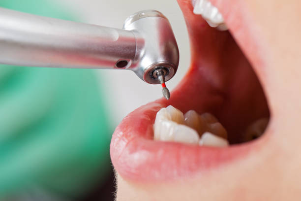 Best Urgent Tooth Repair  in Tsaile, AZ